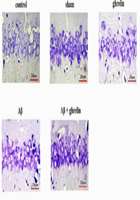 The effect of ghrelin on antioxidant status in the rats model of Alzheimers disease induced by amyloid beta